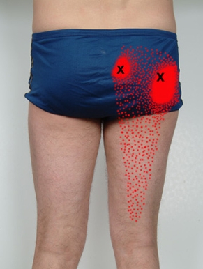 pain pattern for piriformis